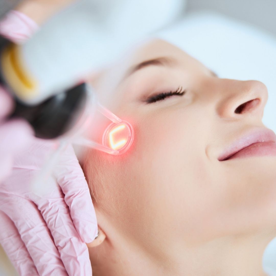 Fractional CO₂ laser in Izmir for acne scars and skin resurfacing after dermatologist assessment by Dr. Sedef Demirer