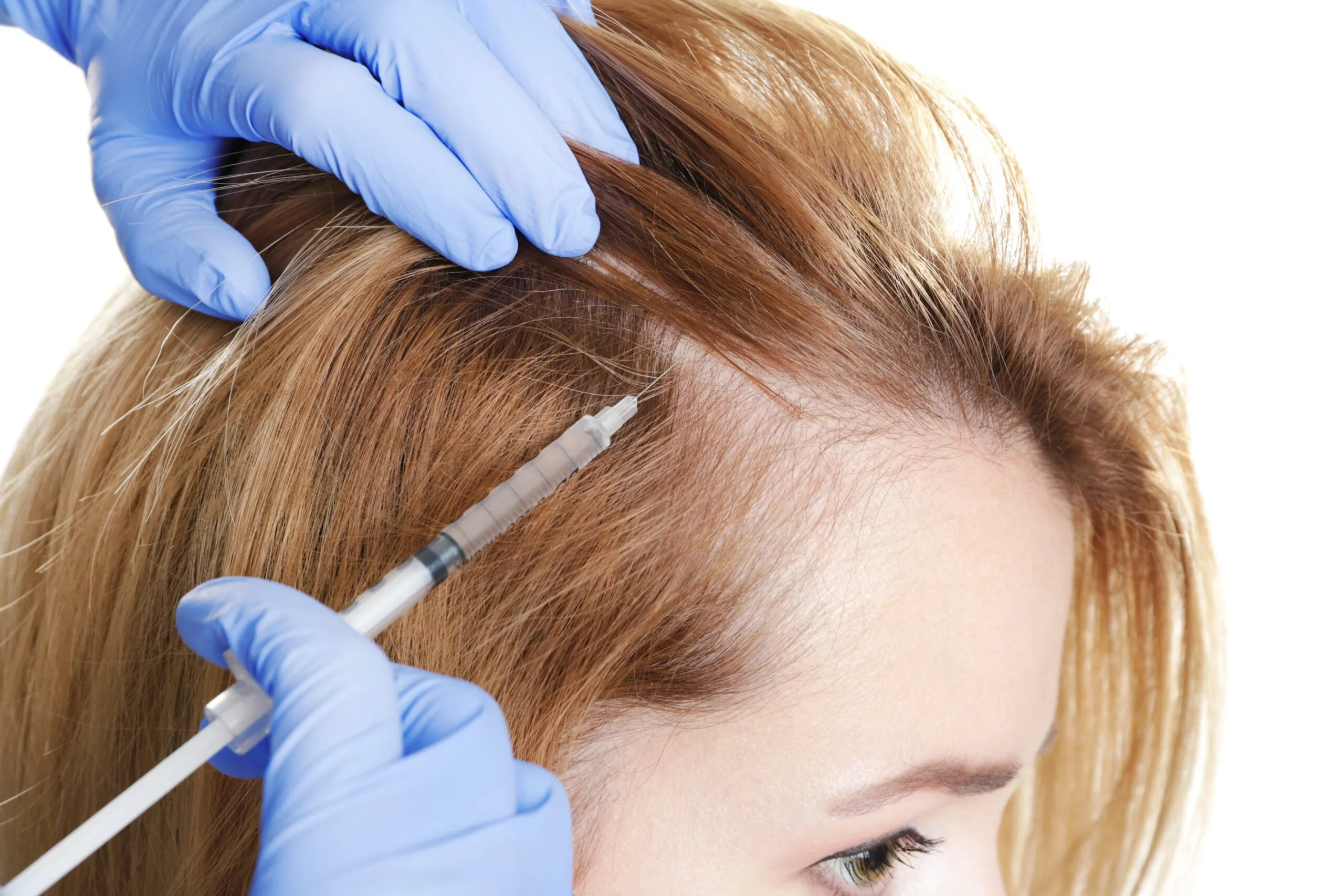 Hair loss treatment in Izmir with dermatologist assessment of the cause and diagnosis-based treatment planning by Dr. Sedef Demirer