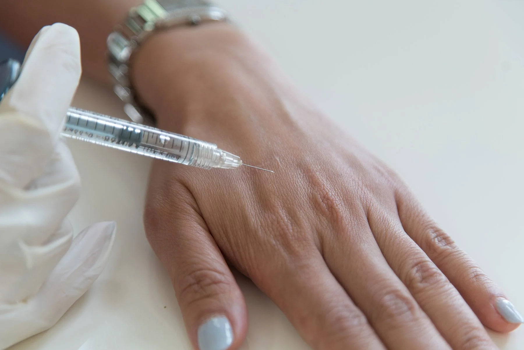 Handfiller in Izmir zur Beurteilung von Volumenverlust und Hautstruktur an den Händen bei Dr. Sedef Demirer